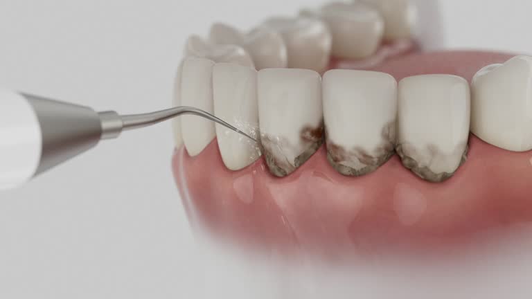 Trusted Emergency Dentist service in Arlington, WA - Dentist Open Now